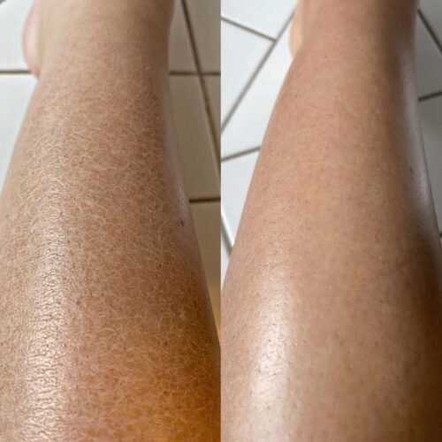 Quad Bundle photo review